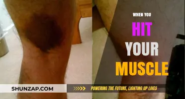 How to Recover from a Pulled Muscle