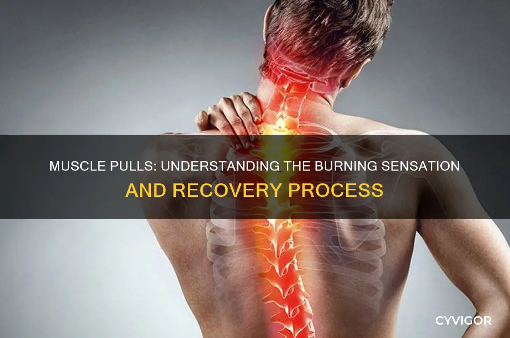 when you pull a muscle does it burn