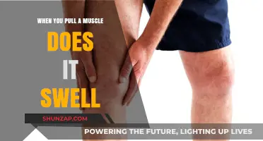 Pulled Muscle Swelling: Causes, Symptoms, and Effective Recovery Tips