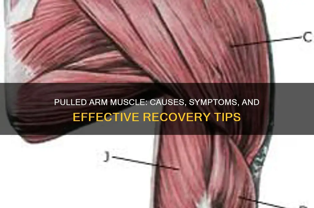 when you pull a muscle in your arm