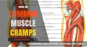 Unraveling the Mystery: Where Do Muscle Cramps Commonly Strike?