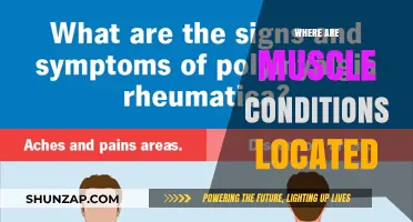 Muscle Conditions: Location, Location, Location