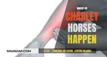 Charley Horses: Where Do They Strike?