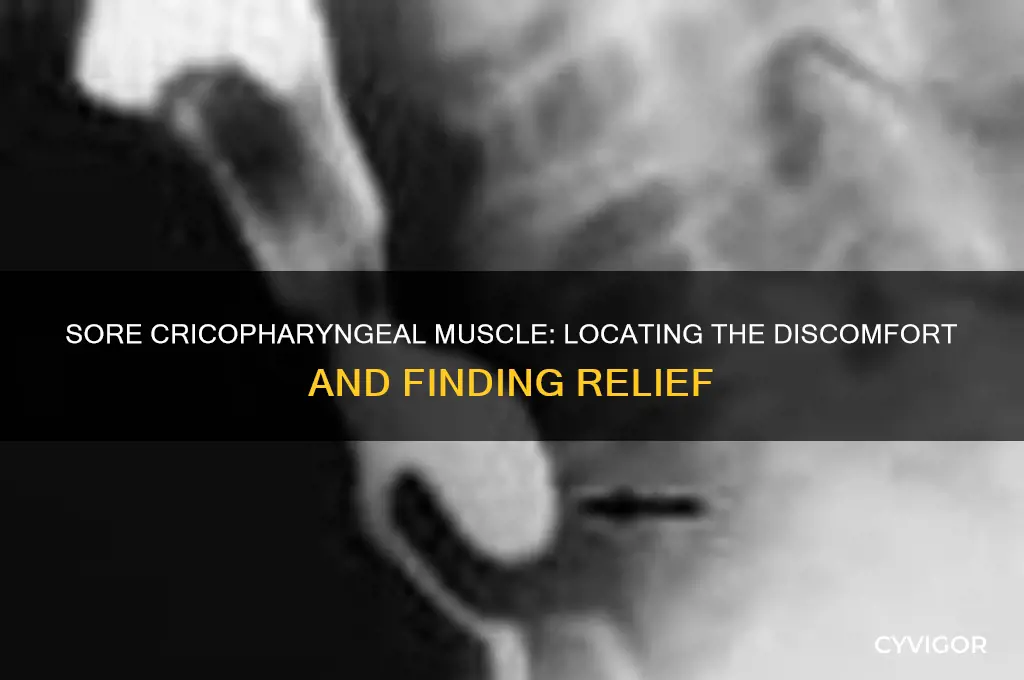 where do you feel a sore cricopharyngeal muscle at