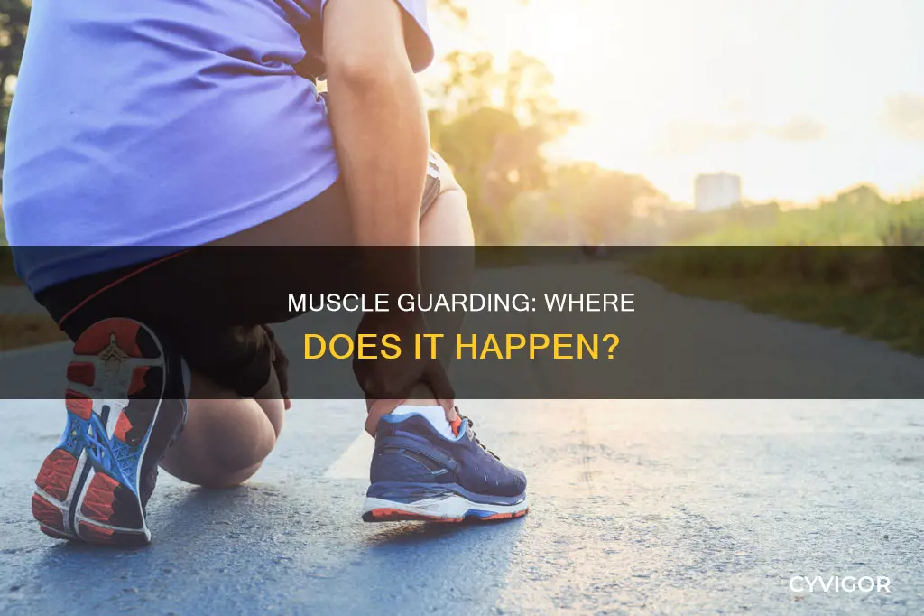 where does muscle guarding occur