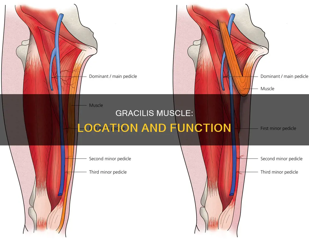 where is gracilis muscle