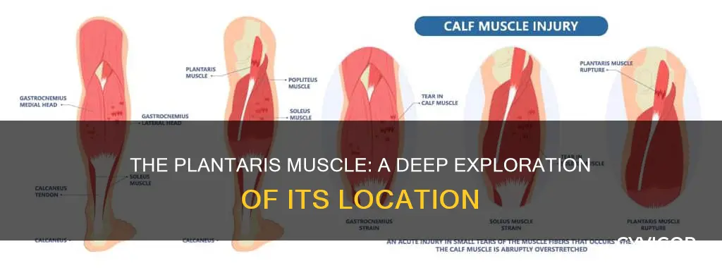 where is the plantaris muscle