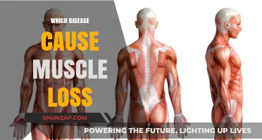 Understanding Muscle Loss: Diseases That Lead to Muscle Atrophy