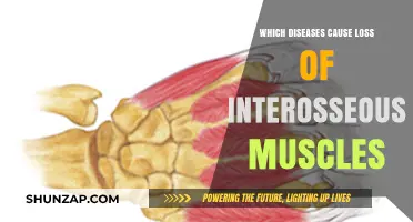 Understanding Diseases Leading to Interosseous Muscle Atrophy and Weakness