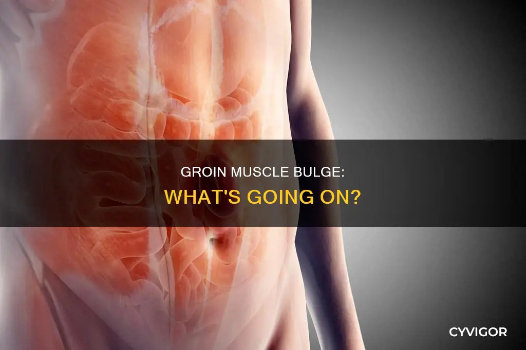 which groin muscle sticks out
