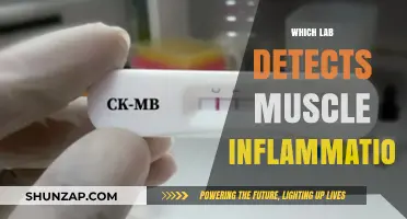 Lab Tests for Muscle Inflammation: What You Need to Know