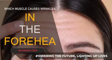 How Forehead Wrinkles Are Caused by Muscles