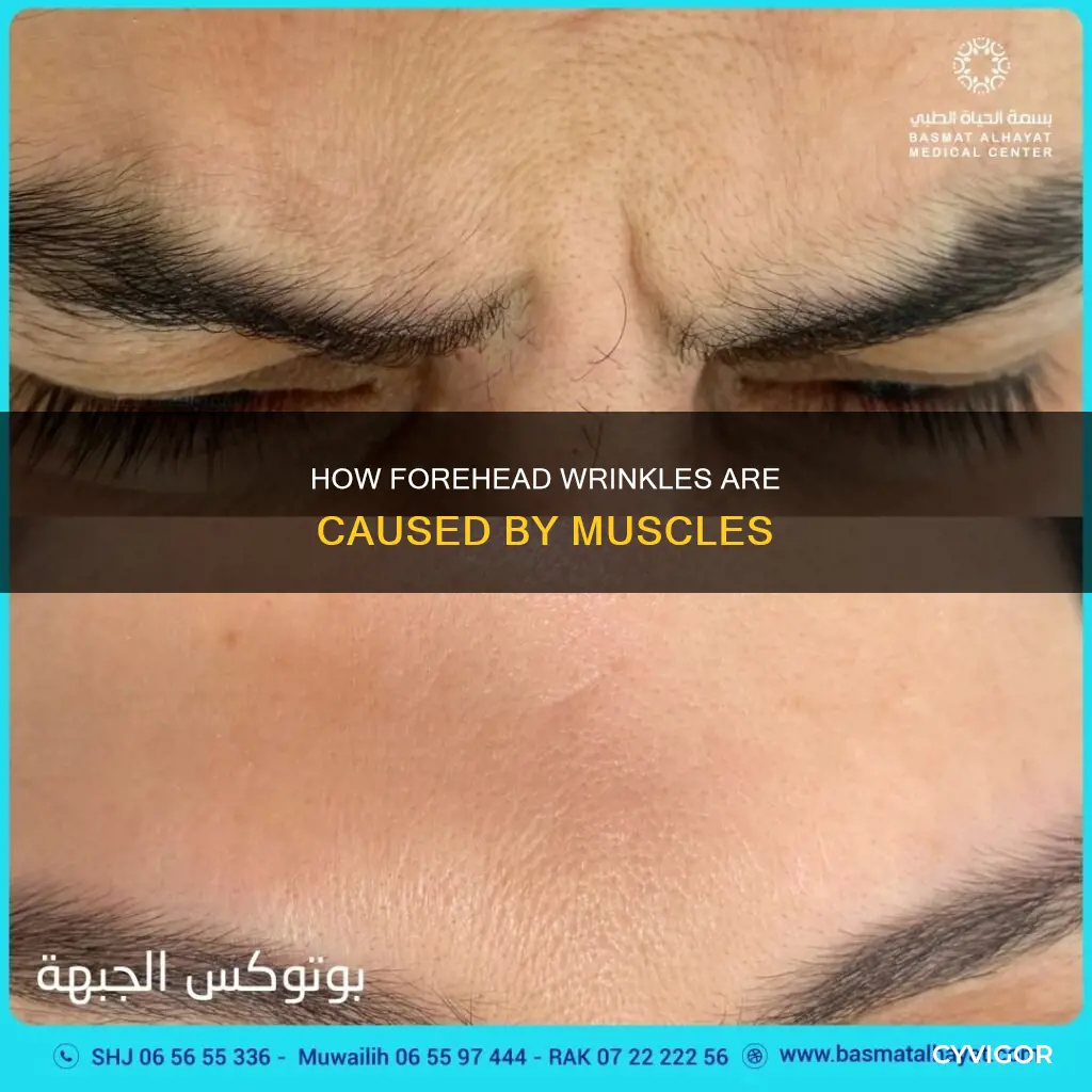 which muscle causes wrinkles in the forehead