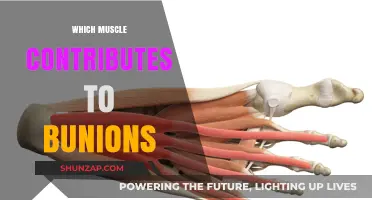 Big Toe Joint: Which Muscle Causes Bunions?