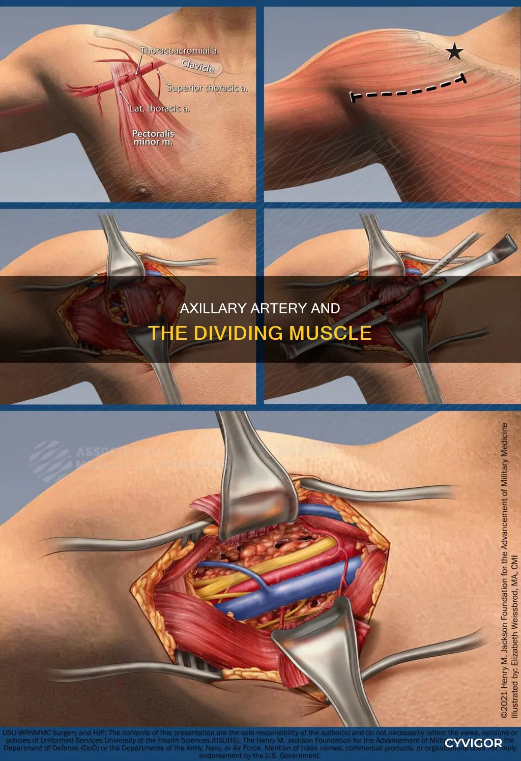 which muscle divides axillary artery