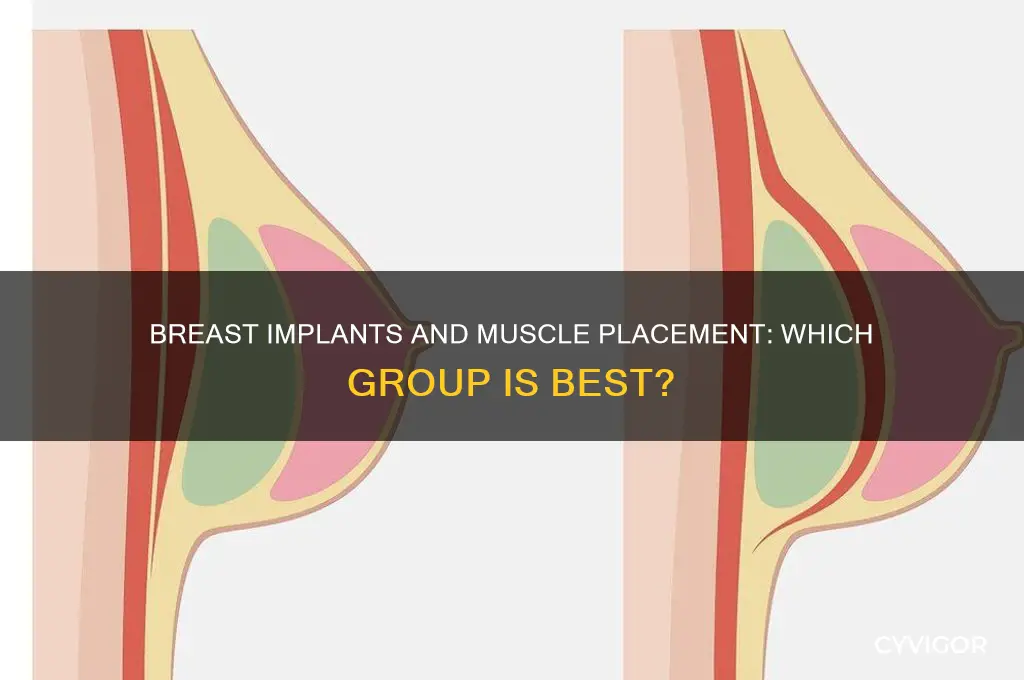 which muscle group breast implant