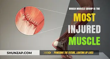 Most Commonly Injured Muscle Groups: Causes, Prevention, and Recovery Tips