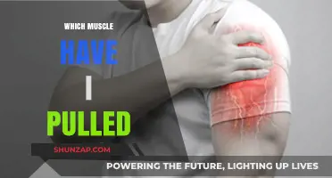 Identifying Pulled Muscles: Symptoms, Causes, and Recovery Tips