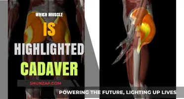 Highlighting Human Anatomy: Which Muscle Stands Out in a Cadaver?