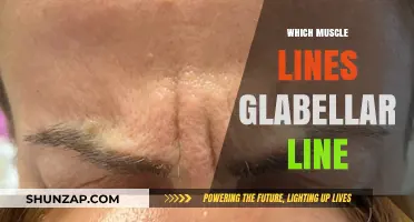 How to Smooth Out the Glabellar Line