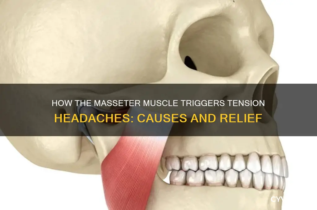 which muscle of mastication causes headaches primarily
