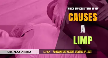 Hip Muscle Strains: Identifying the Culprit Behind Your Limp