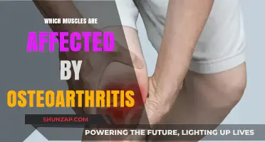 Unveiling the Impact of Osteoarthritis on Your Muscles