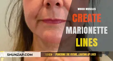 How Facial Muscles Create Marionette Lines