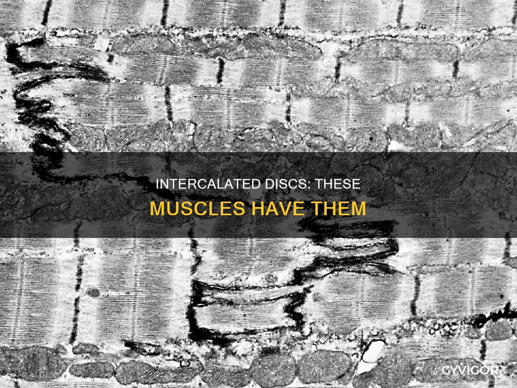 which muscles have intercalated discs