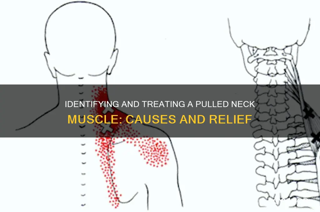 which neck muscle did i pull