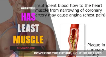Muscle-Free Vessels: Which Has the Least?