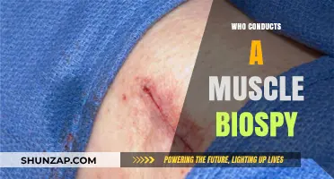 Muscle Biopsy: Who Performs the Procedure?