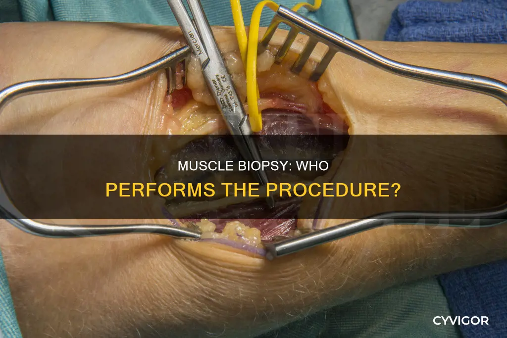 who does a muscle biopsy
