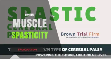 Muscle Spasticity: Who is Affected and Why?