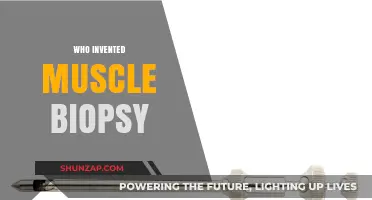 The Origin of Muscle Biopsy: A Medical Breakthrough