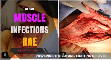 Muscle Infections: Rare but Why?