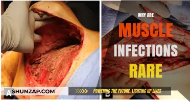 Muscle Infections: Why Are They Uncommon?