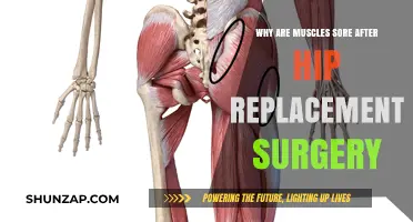 Understanding Post-Hip Replacement Muscle Soreness: Causes and Recovery Tips