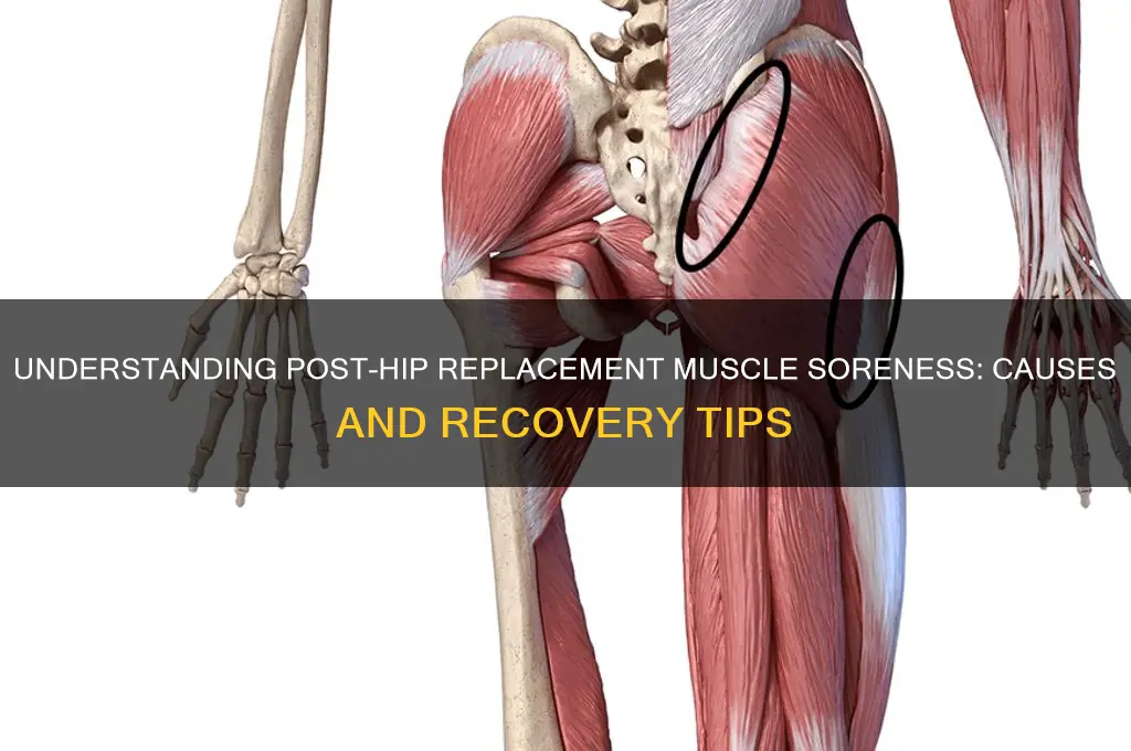 why are muscles sore after hip replacement surgery