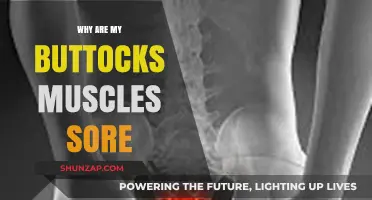 Why Your Buttocks Muscles Are Sore: Causes and Remedies