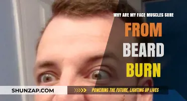 Why Face Muscles Ache from Beard Burn: Causes and Relief
