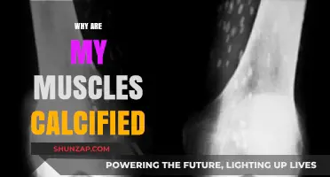 Muscle Calcification: What's the Mystery Behind it?