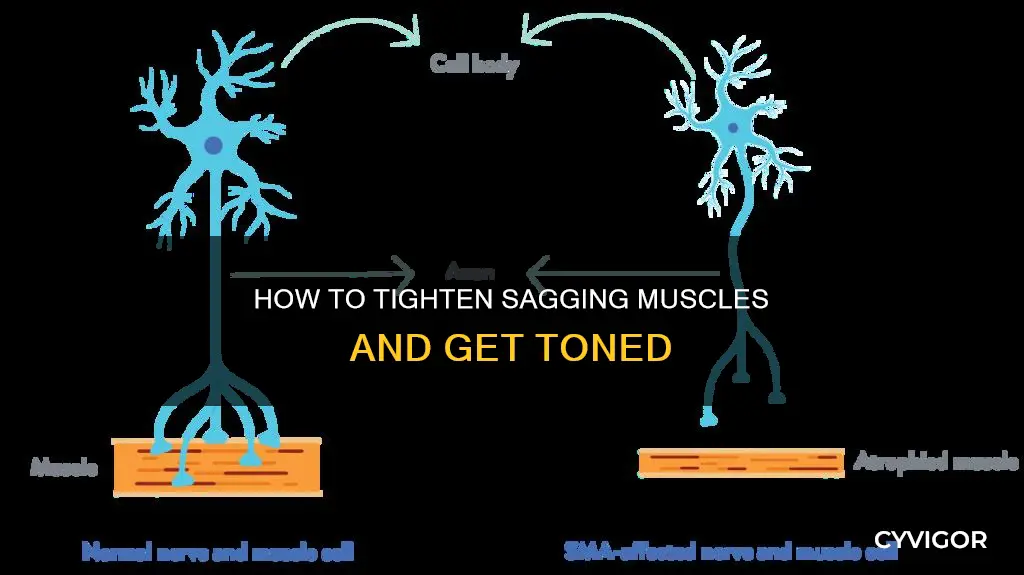 why are my muscles sagging