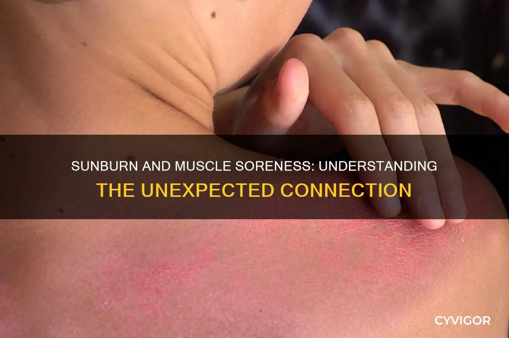 why are my muscles sore after a sunburn