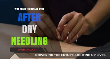 Understanding Post-Dry Needling Muscle Soreness: Causes and Relief Tips