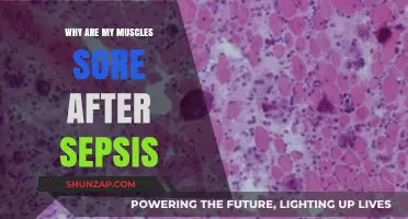 Understanding Post-Sepsis Muscle Soreness: Causes and Recovery Tips