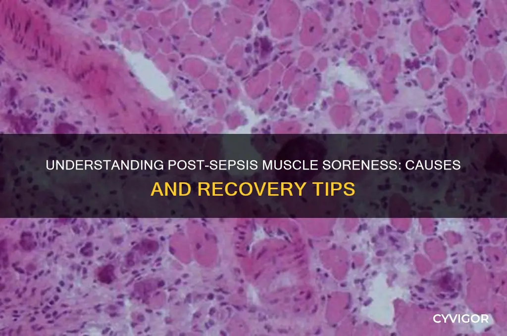 why are my muscles sore after sepsis