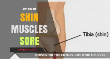 Shin Muscle Soreness: Causes, Prevention, and Effective Relief Strategies