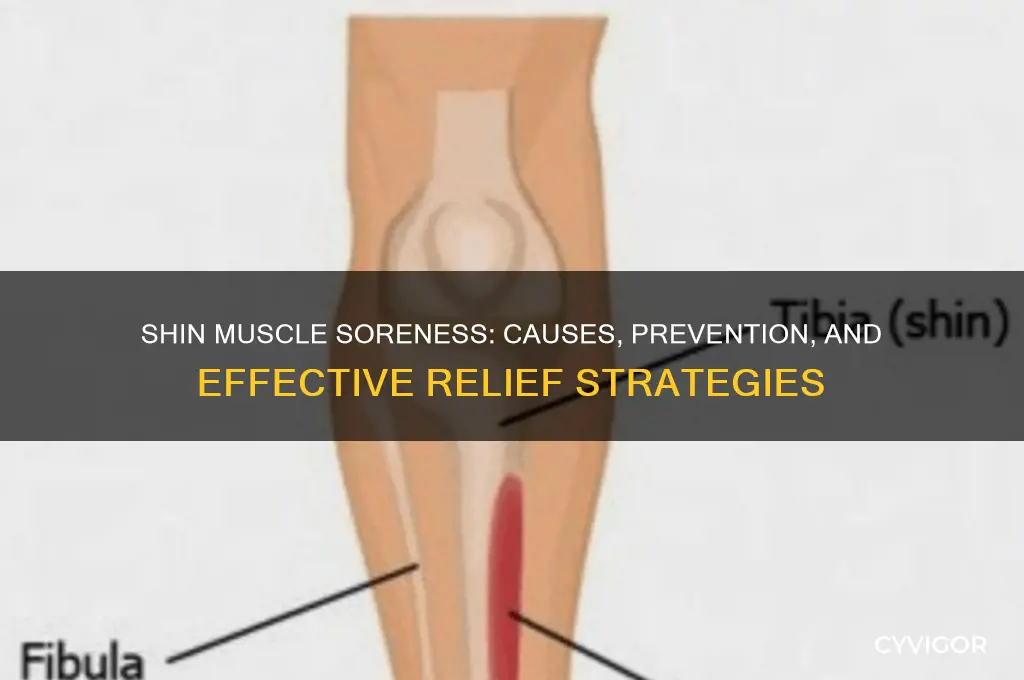 why are my shin muscles sore