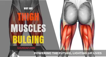 Thigh Muscles Bulging: What's the Reason?